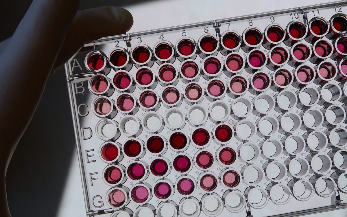 Smart packaging with colorimetric sensors for real-time food quality monitoring